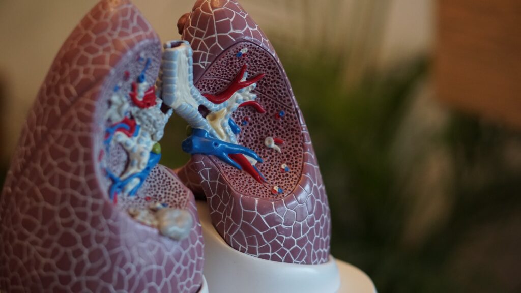 An Overview of Lung Cancer