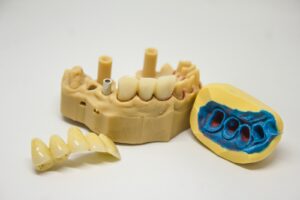 Be Aware That Fluoride Can Discolor Teeth