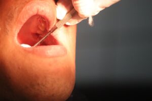 Oral Devices For Sleep Apnea Should Be Fitted By A Specialist