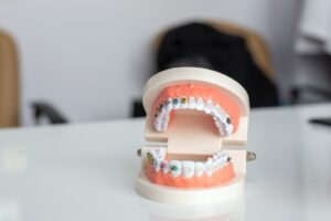 Things To Consider Before Attempting Teeth Whitening