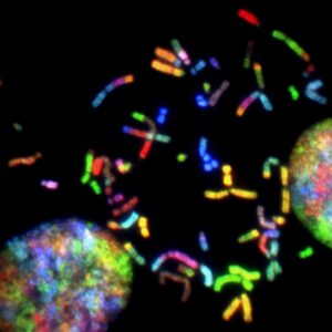 Genetic mutations can lead to high cholesterol if they cause an increased number of LDL receptors