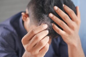 Hair Loss Treatment and Prevention