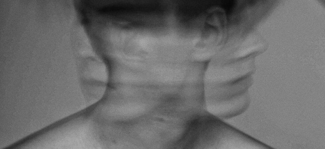 Causes And Solutions For Dandruff Issues