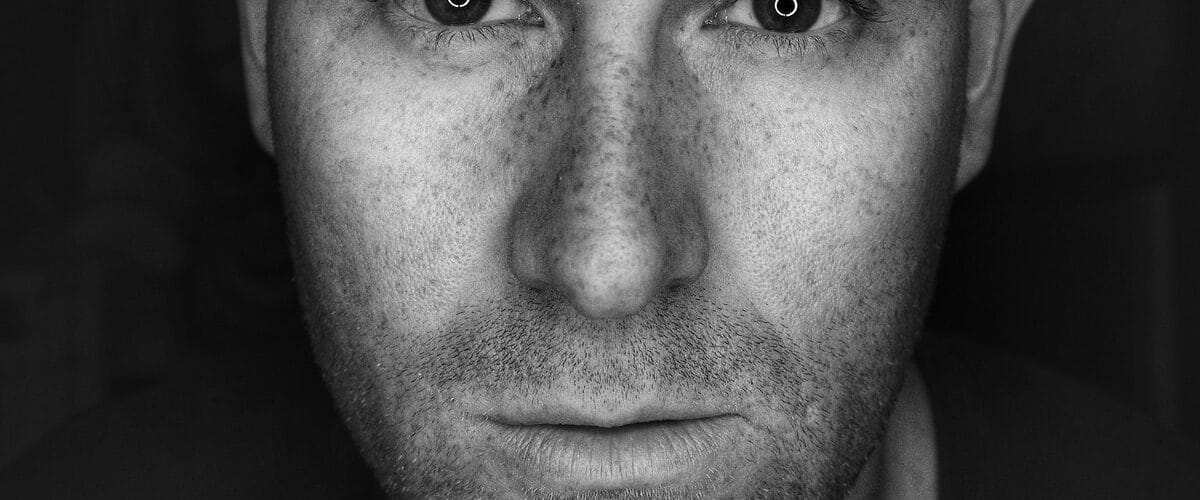 Why Some Acne Treatments Will Not Work For Some People