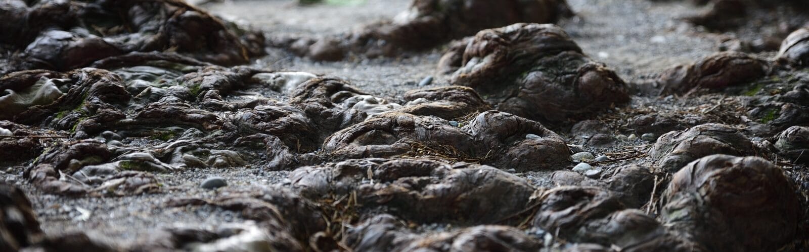 What You Should Do If You Have External Hemorrhoids