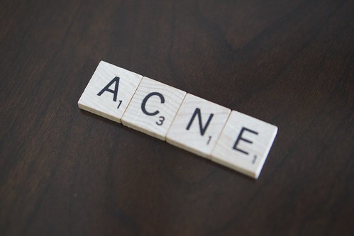 Acne Prevention Resources - Treatments and Remedies