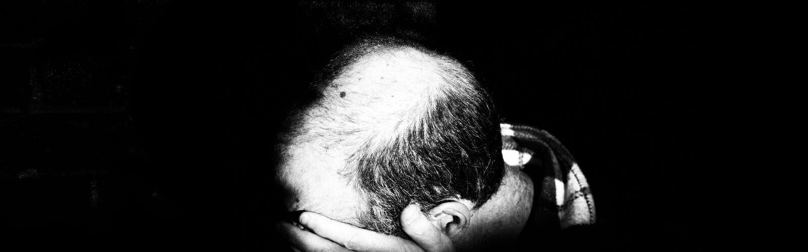 Hair That Is Thinning Or Balding - Things That You Could Do To Get Healthy Hair