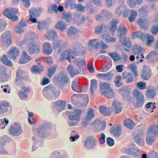 Tips For Fighting Cancer And Also Living With Cancer