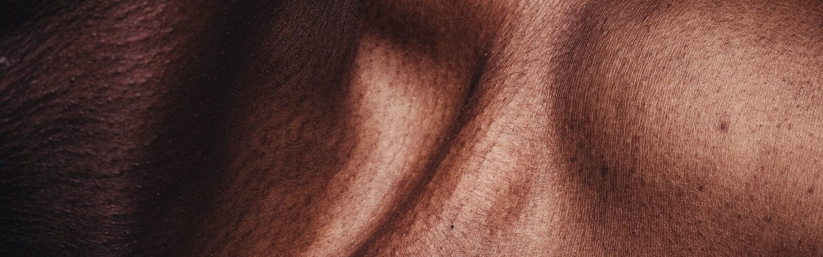 Information About Living With Eczema