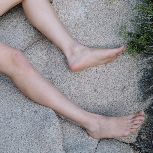 Deep Vein Thrombosis Symptoms of Causes and Risk Factors - Complications and Treatments