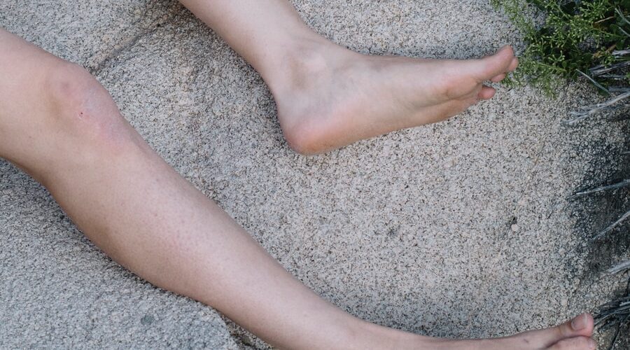 Deep Vein Thrombosis Symptoms of Causes and Risk Factors - Complications and Treatments