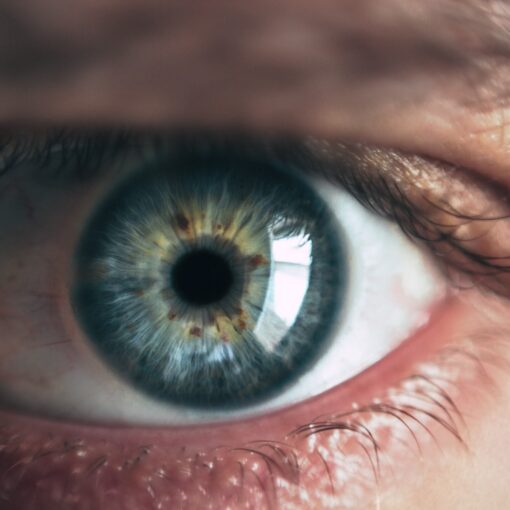 Conjunctivitis Symptoms of Causes and Risk Factors - Complications and Treatments