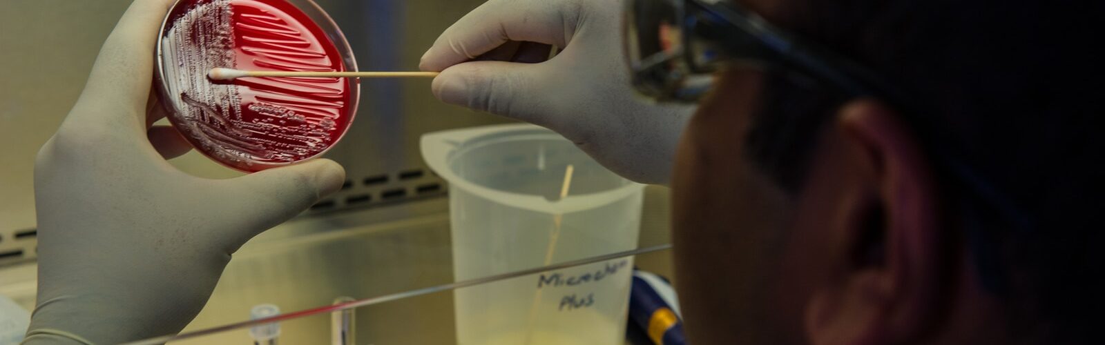 Bacterial Vaginosis Causes of Symptoms and Complications - Risk Factors and Treatments