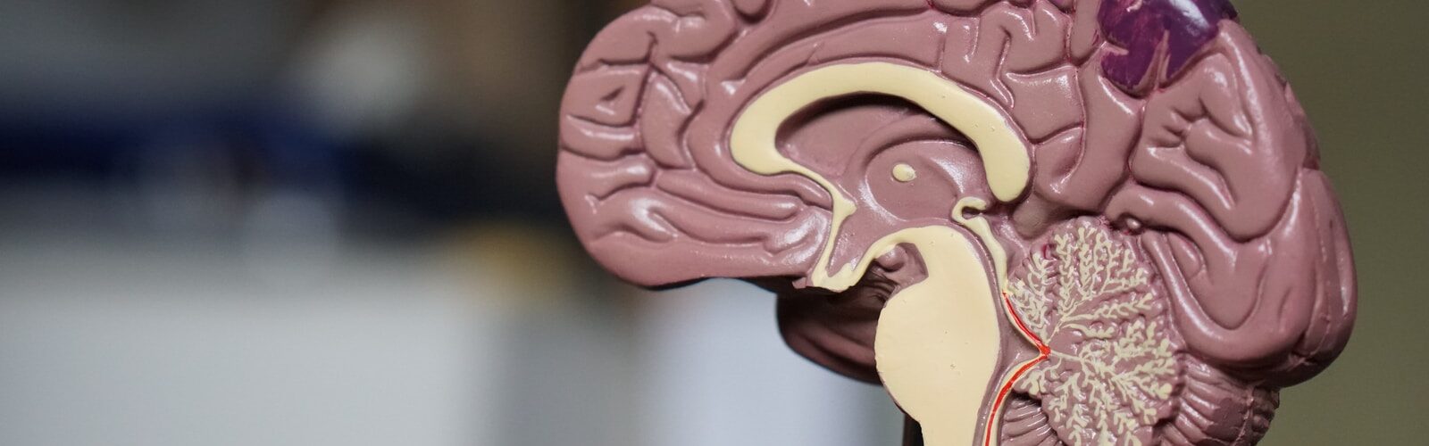 Meningococcal Meningitis Symptoms of Causes and Risk Factors - Complications and Treatments