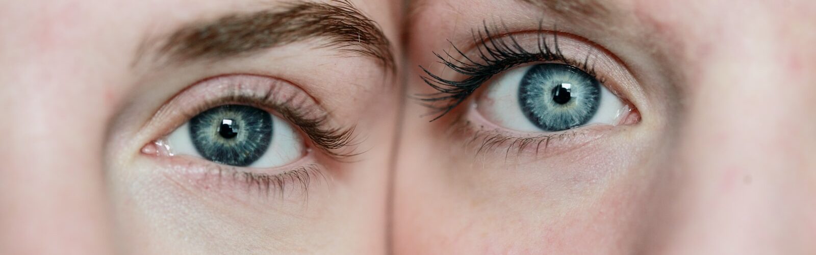 Pinkeye Symptoms - Causes and Risk Factors - Complications and Treatments