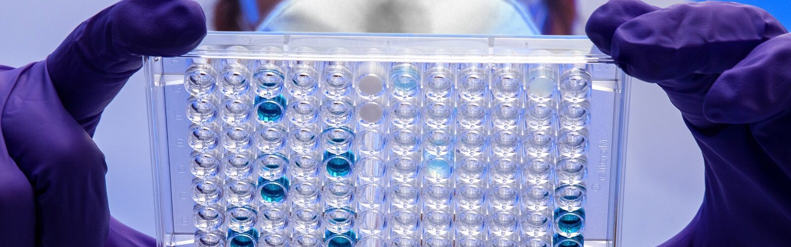 Respiratory Syncytial Virus Symptoms - Causes and Risk Factors - Complications and Treatments