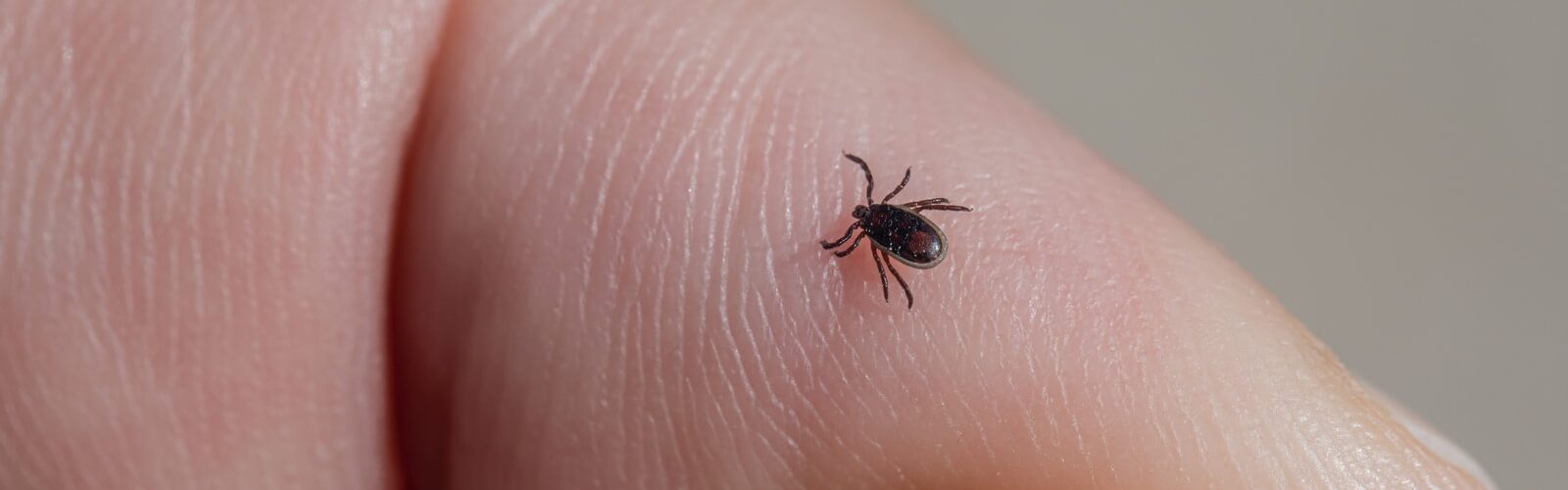 Tickborne Disease Symptoms - Causes and Risk Factors - Complications and Treatments