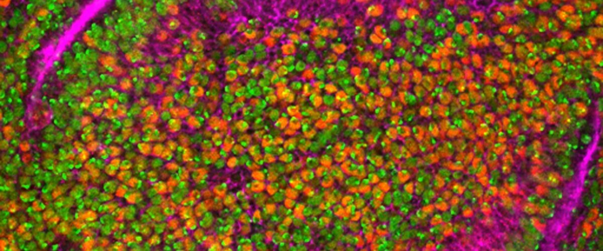 Filoviridae Disease Symptoms of Causes and Risk Factors - Complications and Treatments