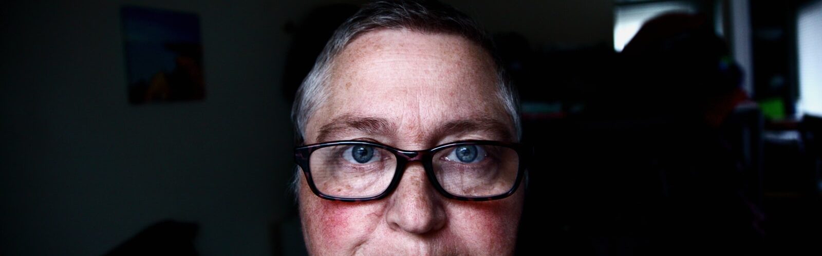 Reduce Rosacea Symptoms