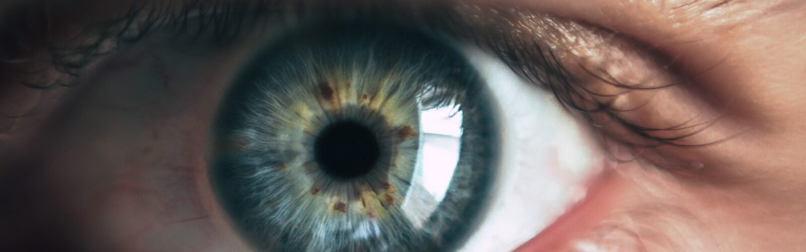 Treatment and Prevention of Eye Floaters