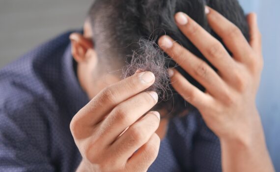 Hair Loss Treatment and Prevention