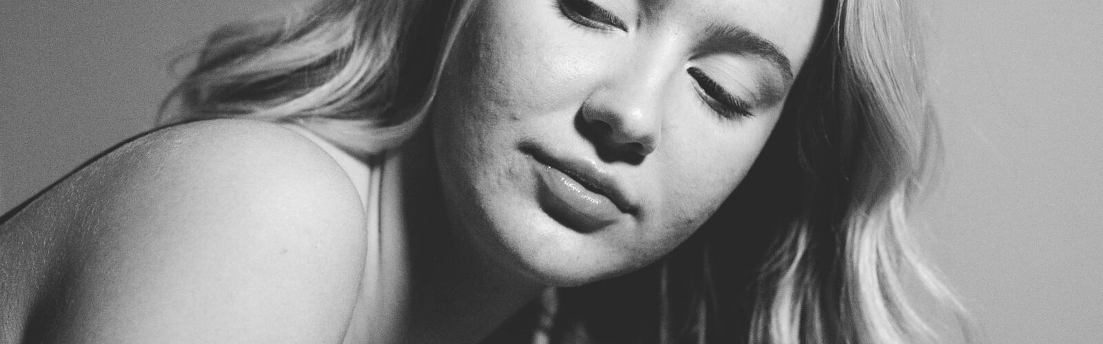 Acne Skin Care Treatments and Remedies