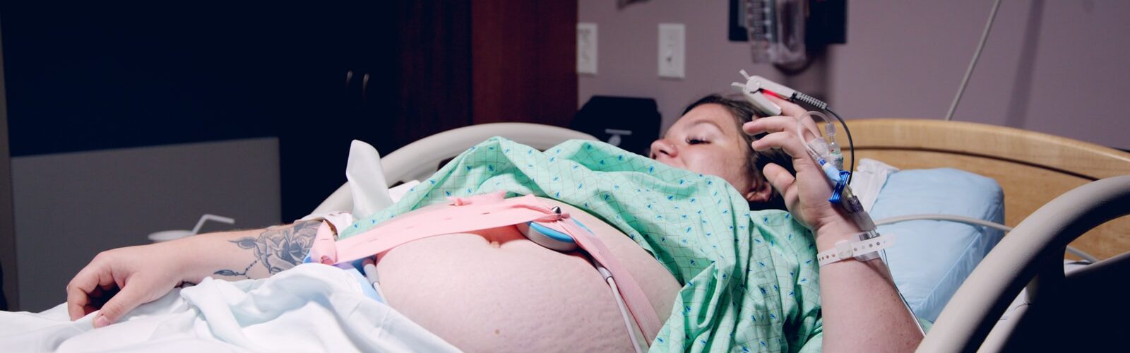 Reducing The Appearance of Stretch Marks