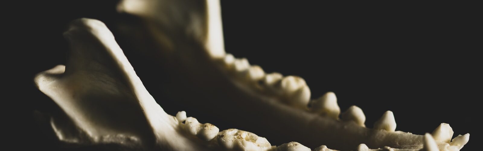 Temporomandibular Joint Treatment and Prevention