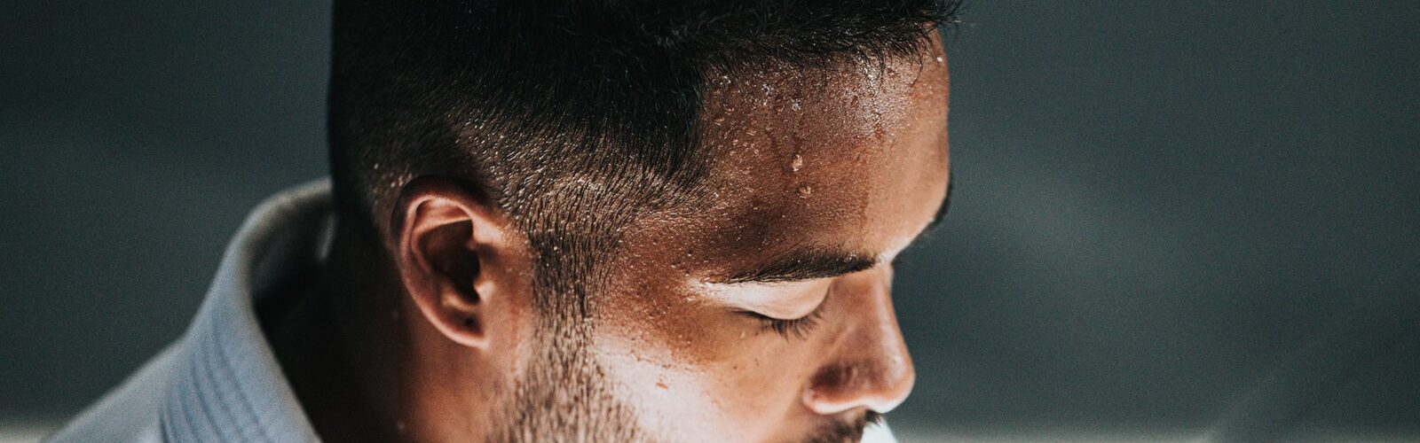 Excessive Sweating - Hyperhidrosis Treatments and Prevention